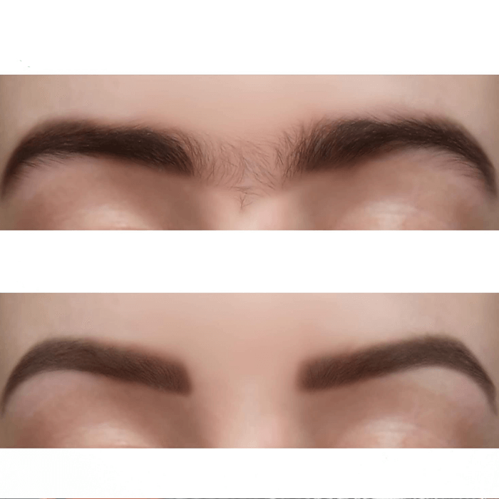 Pfirsichflaum-Entferner