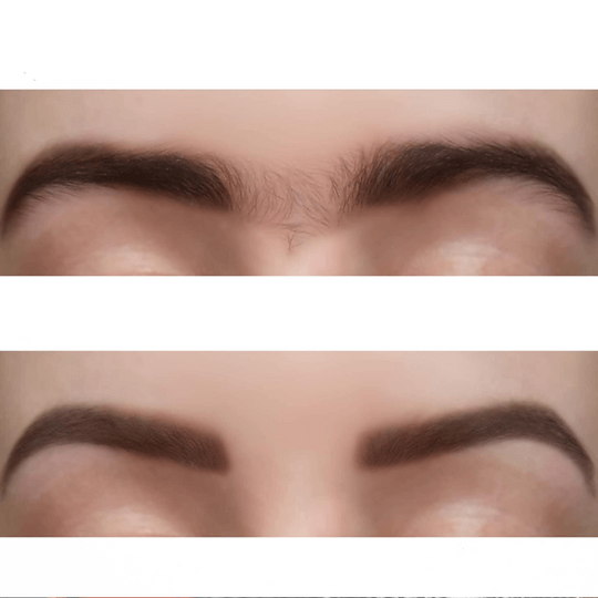 Pfirsichflaum-Entferner